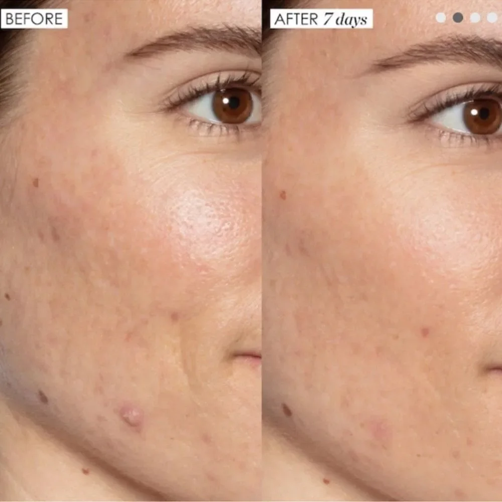 Sunday Riley Good Genes All-In-One Lactic Acid Treatment - Picture 6 of 9
